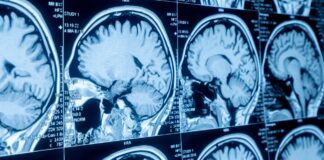 The anatomy of a bid team